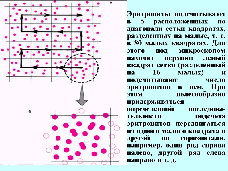 Эритроциты подсчитывают в 5 расположенных по диагонали сетки квадратах, разделенных на малые, т. е.